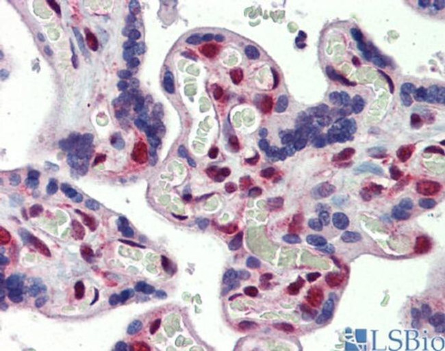 FUBP3 Antibody in Immunohistochemistry (IHC)