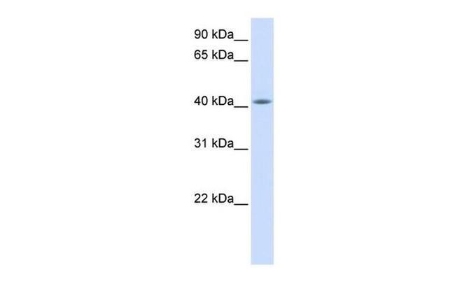 FAM54A Antibody in Western Blot (WB)