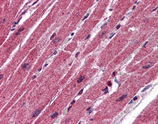 CPN1 Antibody in Immunohistochemistry (IHC)