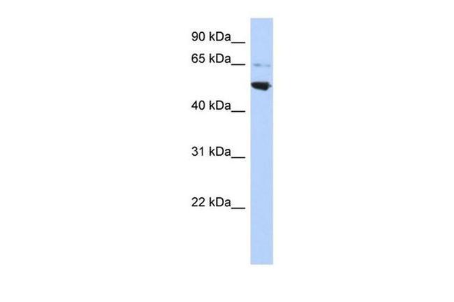 AP3M2 Antibody in Western Blot (WB)