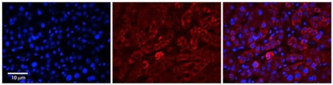 CHP1 Antibody in Immunohistochemistry (Paraffin) (IHC (P))
