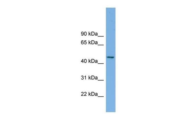 MIPOL1 Antibody in Western Blot (WB)