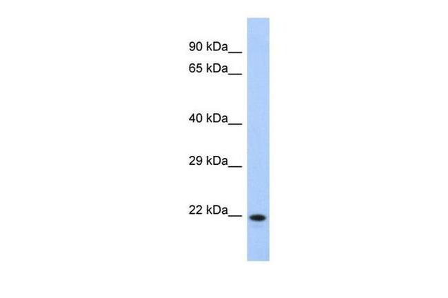 CCDC27 Antibody in Western Blot (WB)
