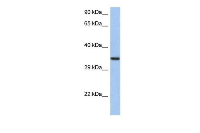 HORMAD2 Antibody in Western Blot (WB)