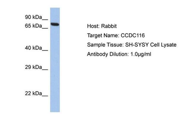 CCDC116 Antibody in Western Blot (WB)