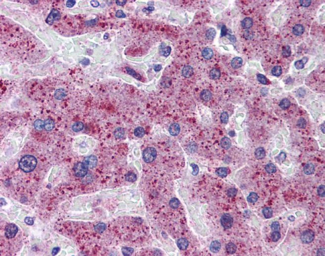 TMPRSS6 Antibody in Immunohistochemistry (IHC)