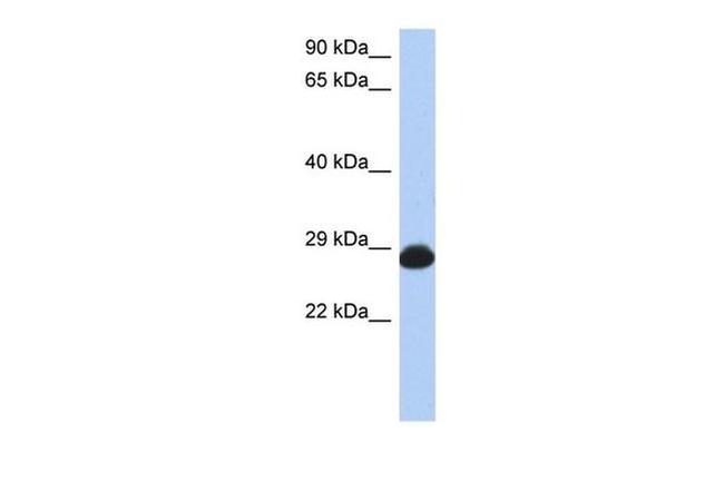RAB39B Antibody in Western Blot (WB)