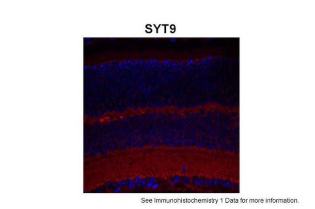 Synaptotagmin 9 Antibody in Immunohistochemistry (IHC)