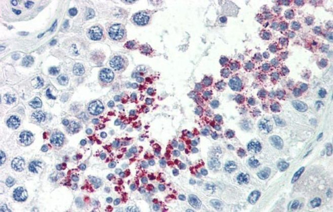 KLB Antibody in Immunohistochemistry (IHC)