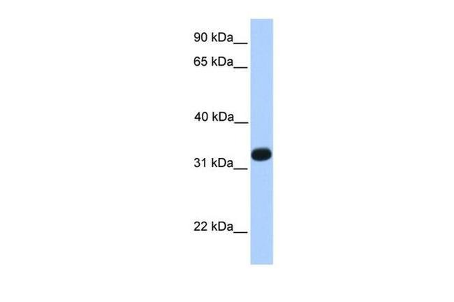Acrosomal Vesicle Protein Antibody in Western Blot (WB)
