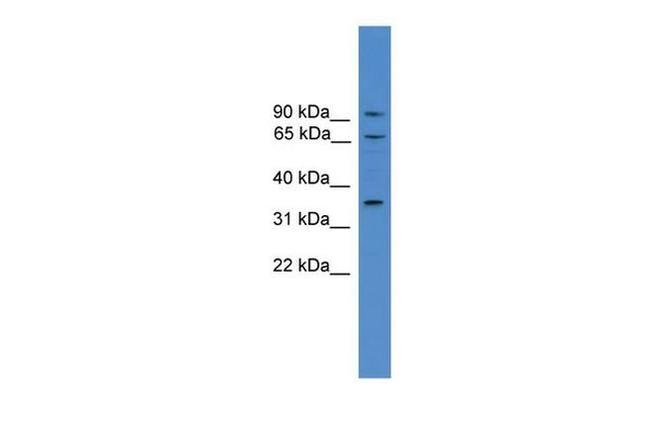 CCIN Antibody in Western Blot (WB)
