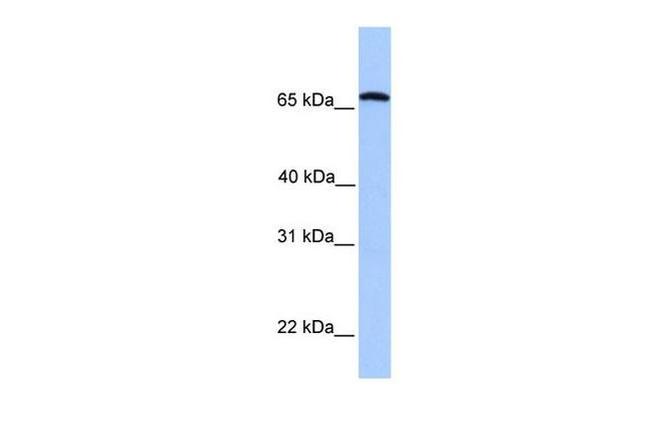 CCIN Antibody in Western Blot (WB)