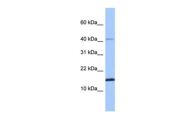 SPAG11B Antibody in Western Blot (WB)