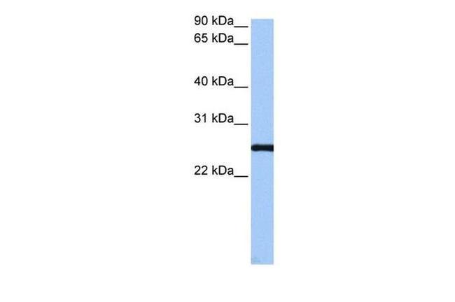 CEP112 Antibody in Western Blot (WB)