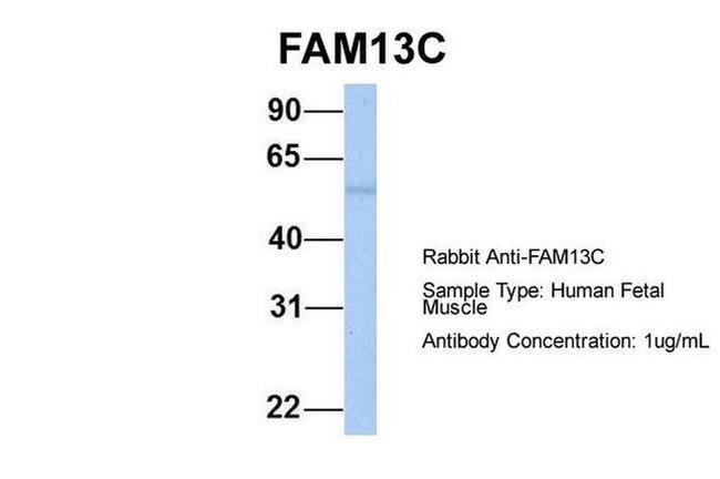 FAM13C Antibody in Western Blot (WB)