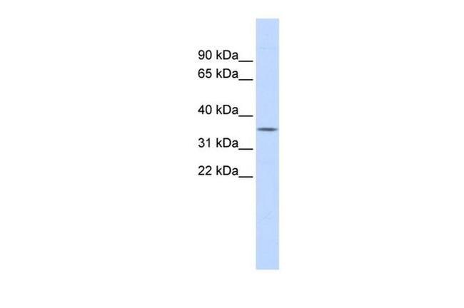 FCN1 Antibody in Western Blot (WB)