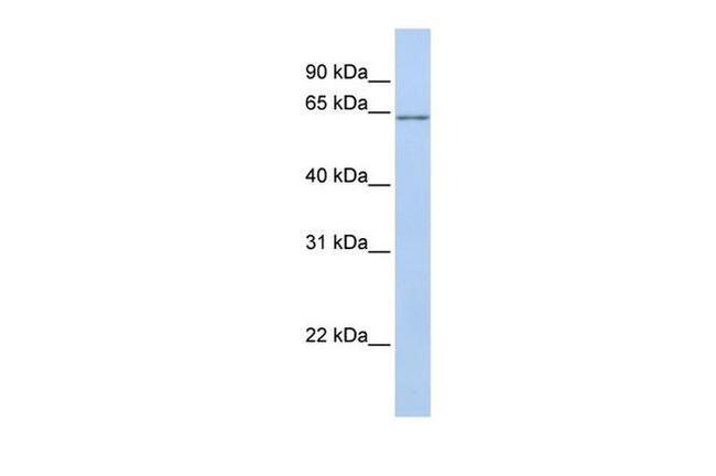 ANGPTL2 Antibody in Western Blot (WB)