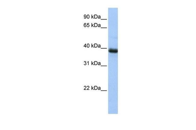 SPO11 Antibody in Western Blot (WB)