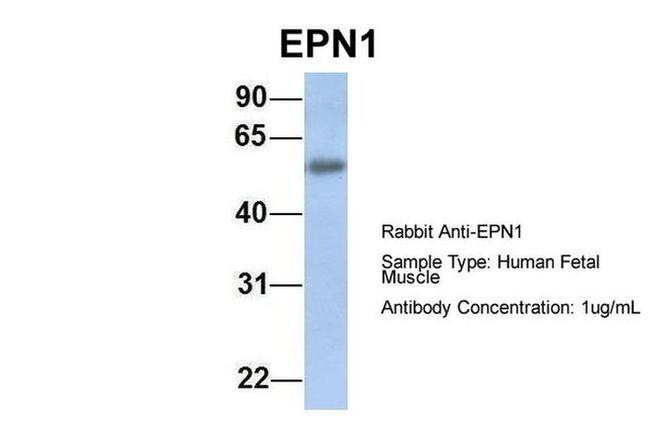Epsin 1 Antibody in Western Blot (WB)