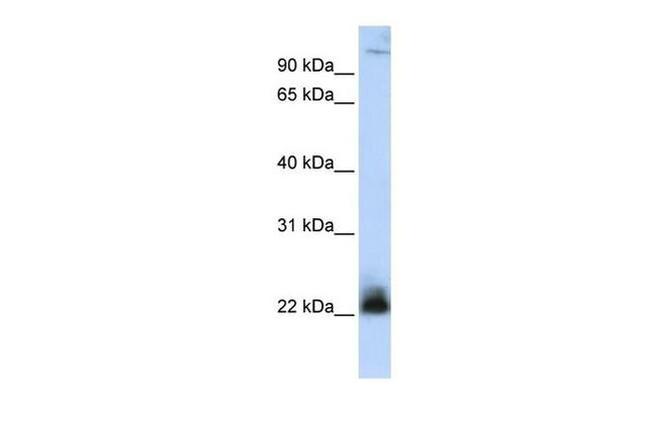 ITGB3BP Antibody in Western Blot (WB)