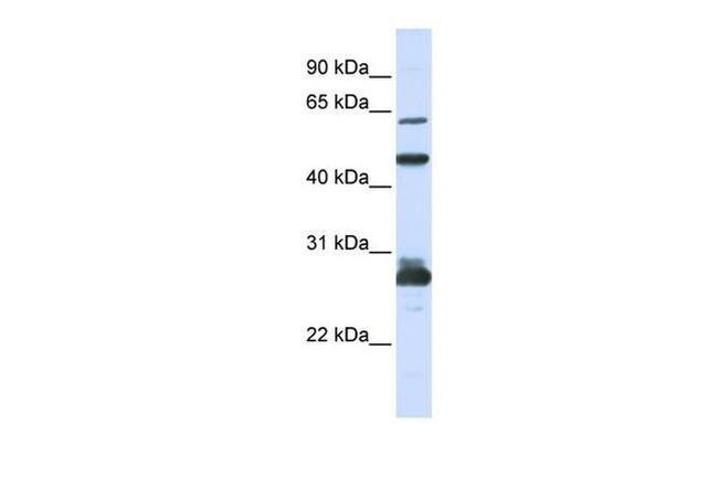 PES1 Antibody in Western Blot (WB)