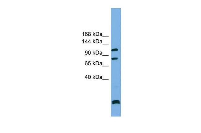 PPP6R1 Antibody in Western Blot (WB)