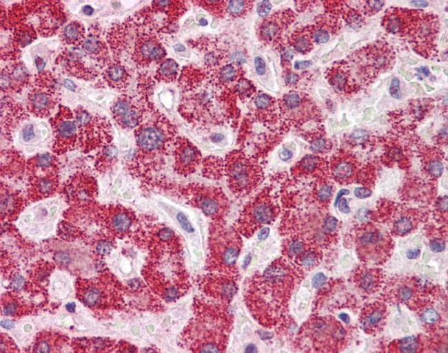 SH2B1 Antibody in Immunohistochemistry (IHC)