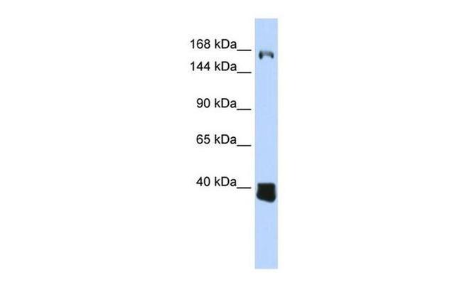 LCOR Antibody in Western Blot (WB)