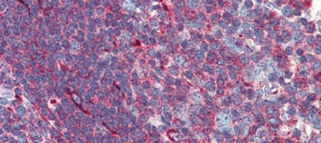 PHACTR1 Antibody in Immunohistochemistry (IHC)