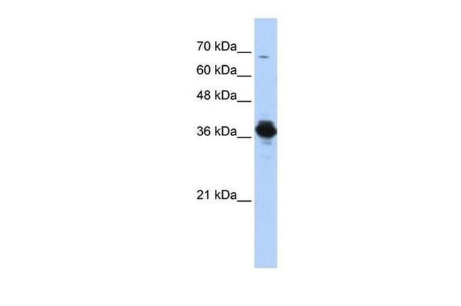 ATP6V0D2 Antibody in Western Blot (WB)