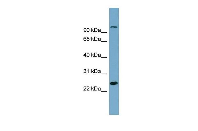 SEMA3D Antibody in Western Blot (WB)