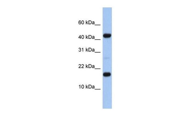 C5orf64 Antibody in Western Blot (WB)