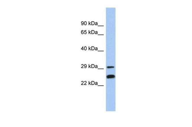 NSE2 Antibody in Western Blot (WB)