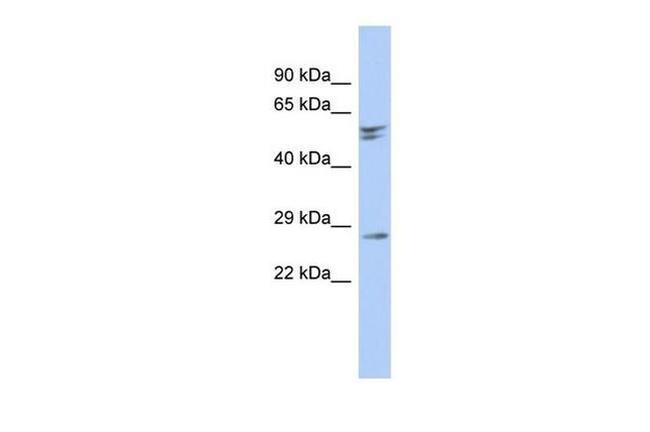 RD3 Antibody in Western Blot (WB)