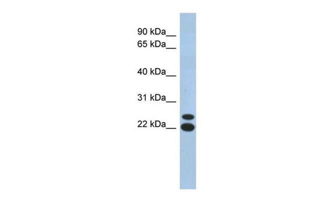 C19orf54 Antibody in Western Blot (WB)