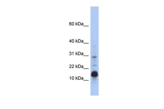 HIST2H2BF Antibody in Western Blot (WB)