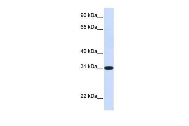 PBLD Antibody in Western Blot (WB)