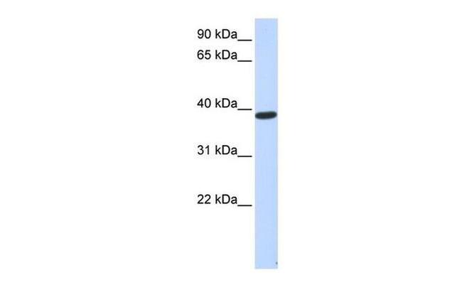 PPP1R7 Antibody in Western Blot (WB)