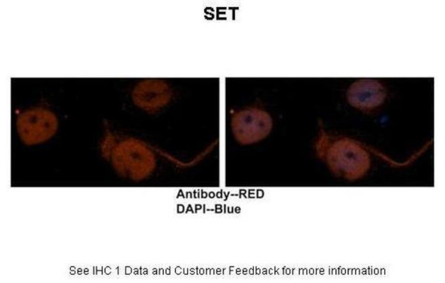 SET Antibody in Immunohistochemistry (IHC)