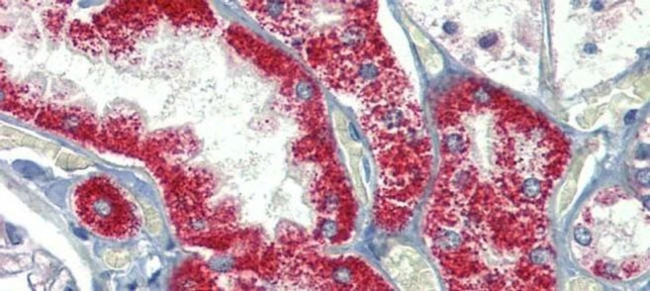 SH3BP2 Antibody in Immunohistochemistry (IHC)
