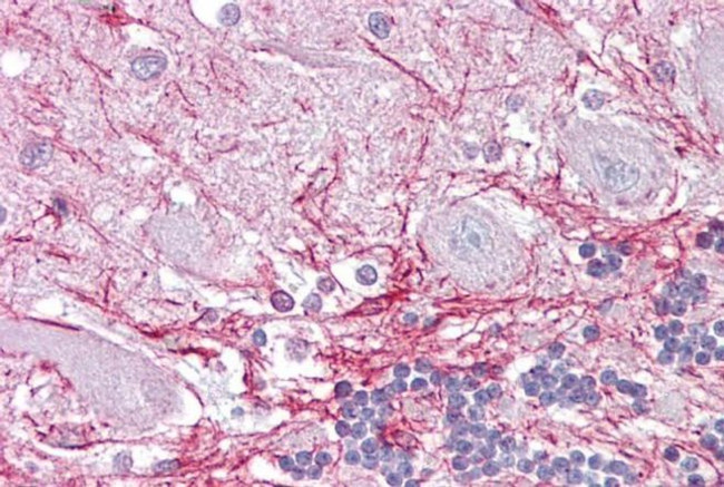 RP2 Antibody in Immunohistochemistry (IHC)
