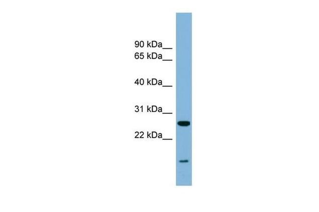 TRAPPC4 Antibody in Western Blot (WB)