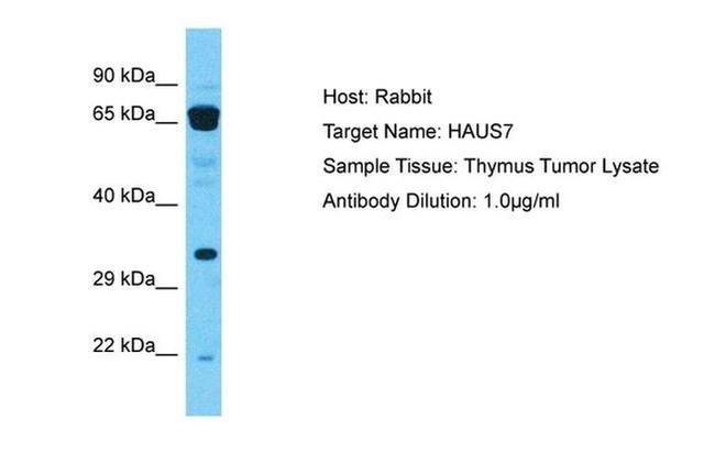 HAUS7 Antibody in Western Blot (WB)