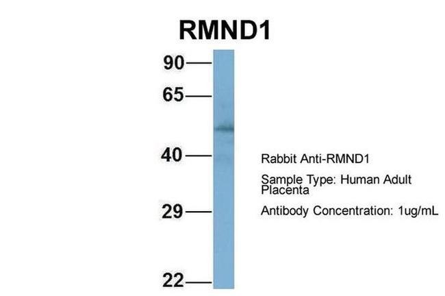 RMND1 Antibody in Western Blot (WB)