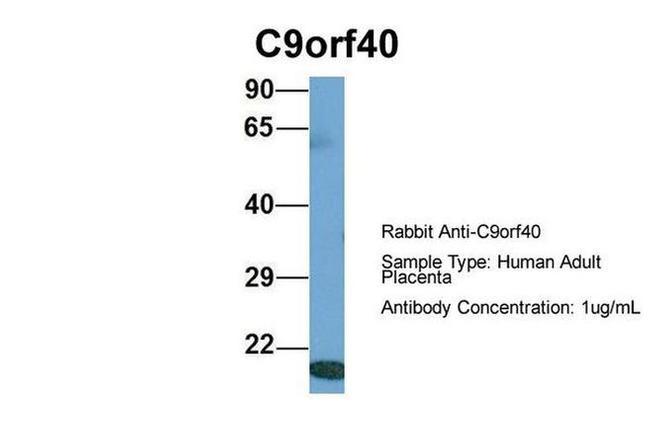 C9orf40 Antibody in Western Blot (WB)