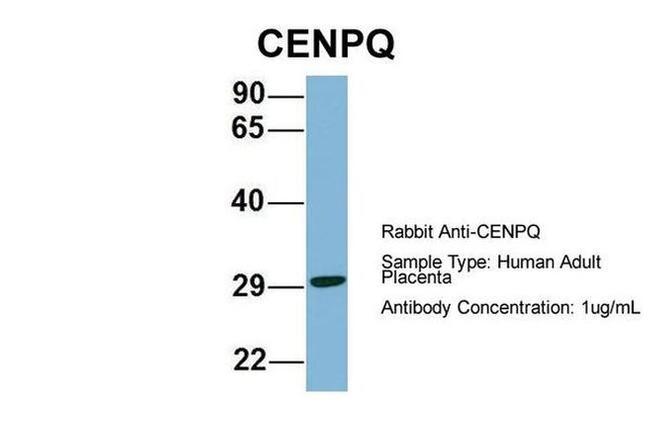 CENPQ Antibody in Western Blot (WB)