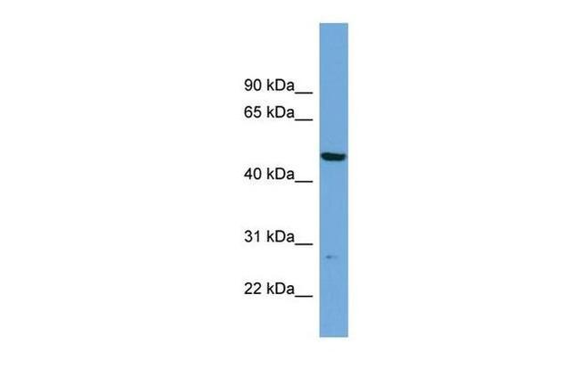 PNMAL1 Antibody in Western Blot (WB)