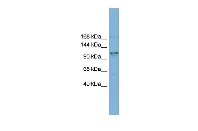 CCDC87 Antibody in Western Blot (WB)