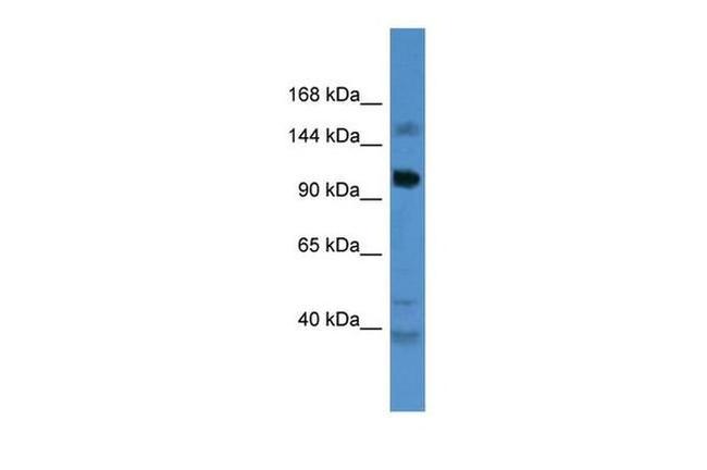 CCDC87 Antibody in Western Blot (WB)