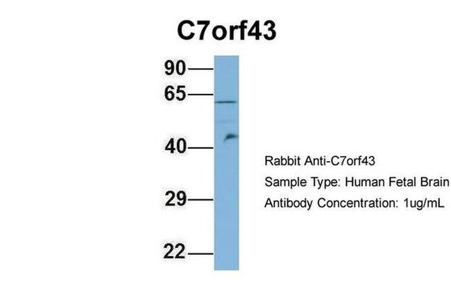 C7orf43 Antibody in Western Blot (WB)